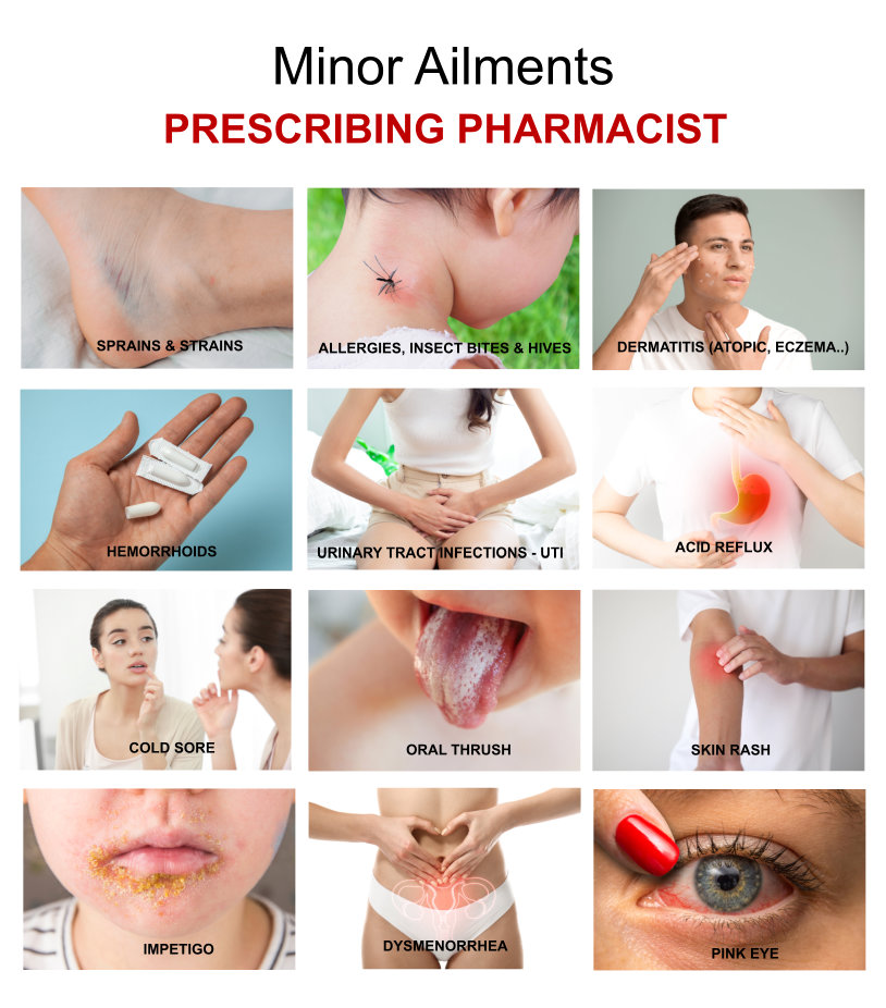 easy prescriptions for common health issues prescribing pharmacist for minor ailments